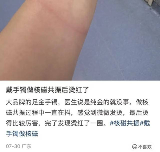 女子做核磁共振忘摘足金手镯，致镯子疯狂抖动？医生提醒